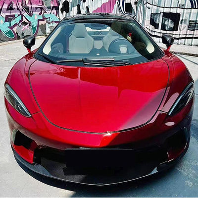 مجموعة جسم الألياف الكربونية الجافة لـ مكلارين جي تي مكلارين جي تي تحديث نمط نوفي كربونيفايبر ديفوزر سبويلر كيس الجسم